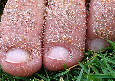 Dedos