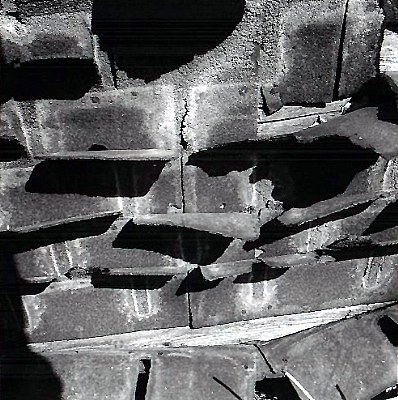 Shingles