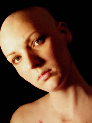 Bald and Beautiful!