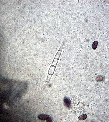Paramecium Hunter