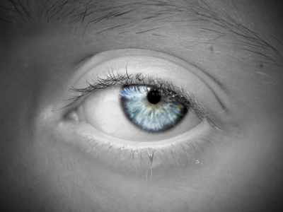 My son's eye