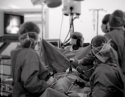laparoscopic Cholecystectomy