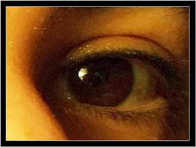 My eye