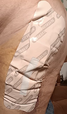 HIP SURGERY BANDAGE